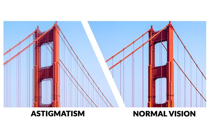 astigmatism vs. normal vision