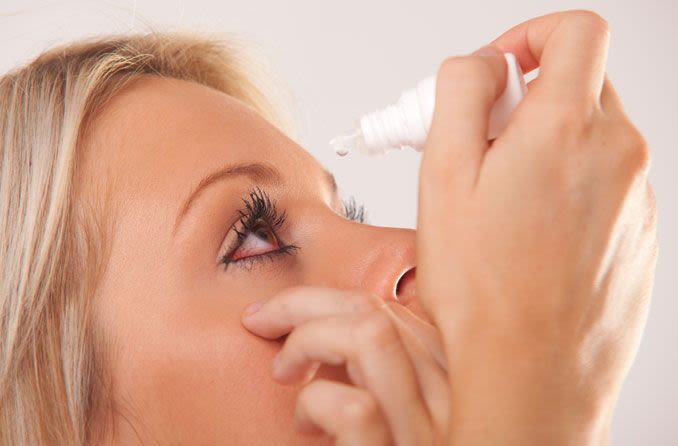 Woman applying eye drop treatment for Conjunctivitis